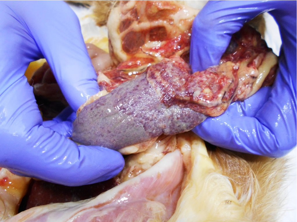 Селезенка покрыта фибриновыми отложениями, спайки с брыжейкой