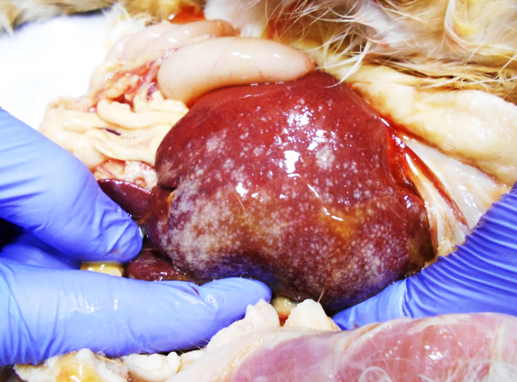 Печень с мелкими белыми очажками и узелками на капсуле